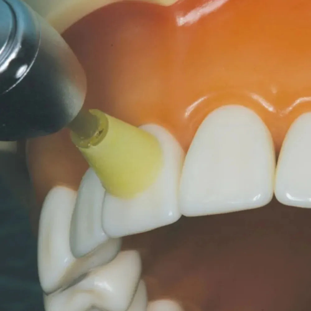 IVeneer Injectable