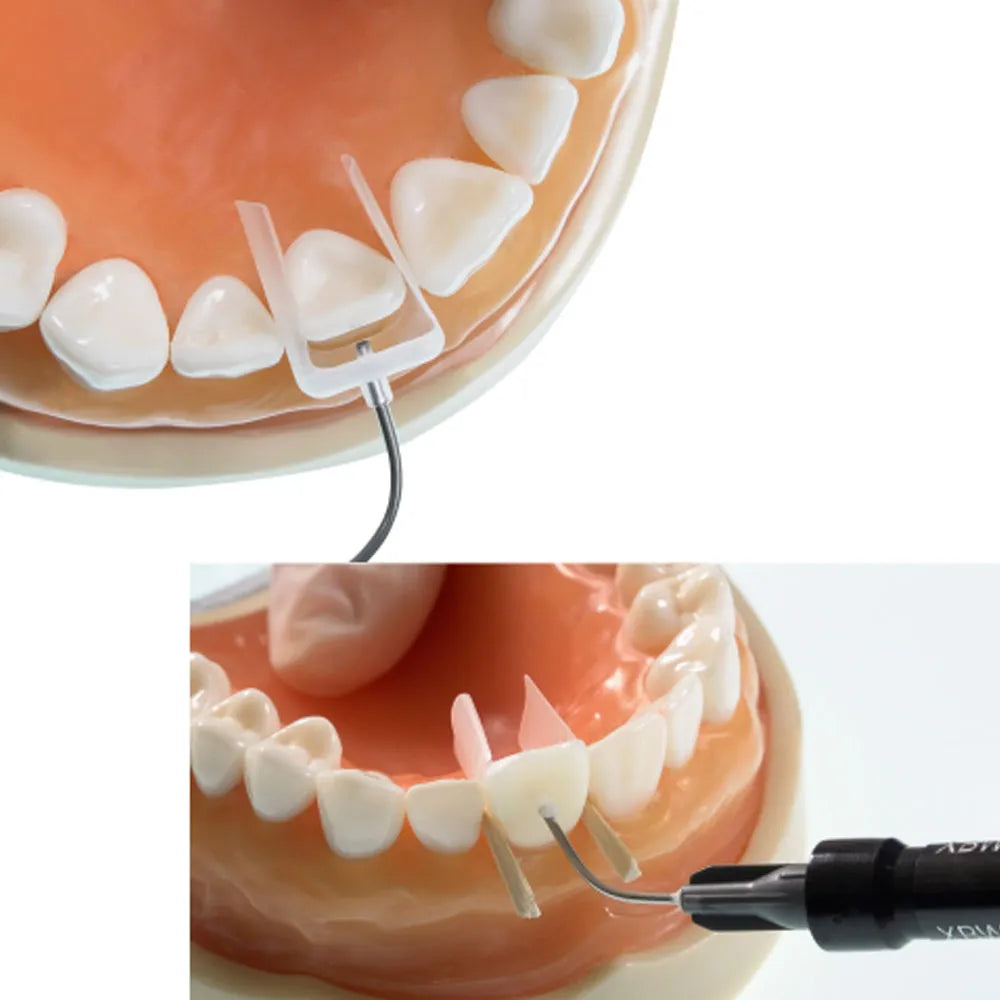 IVeneer Injectable