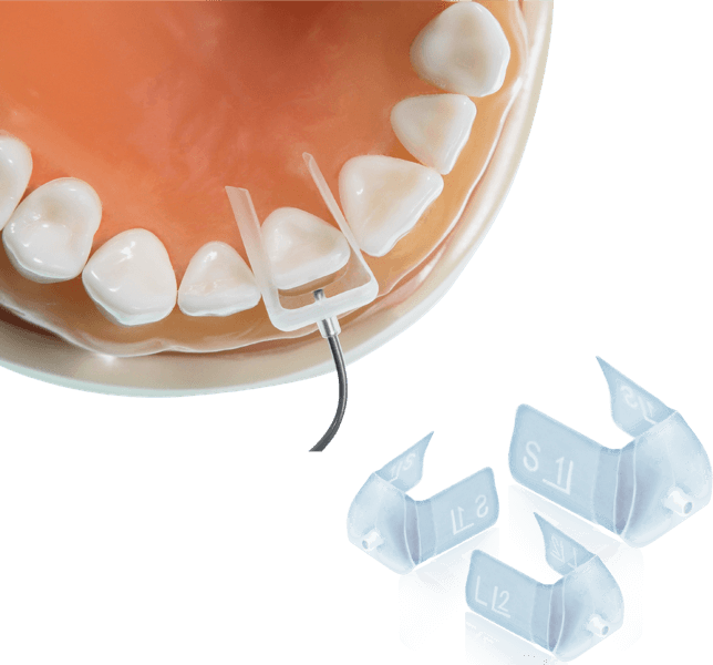 I veener + Composite silicon brushes