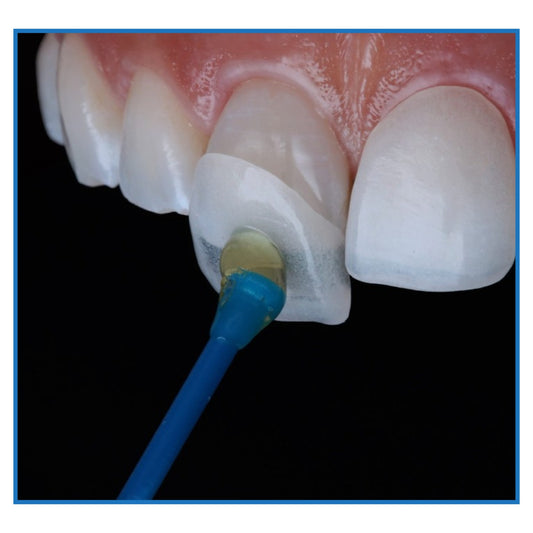 Smart Dental Veneer Stick (Set Of 20 Pcs)