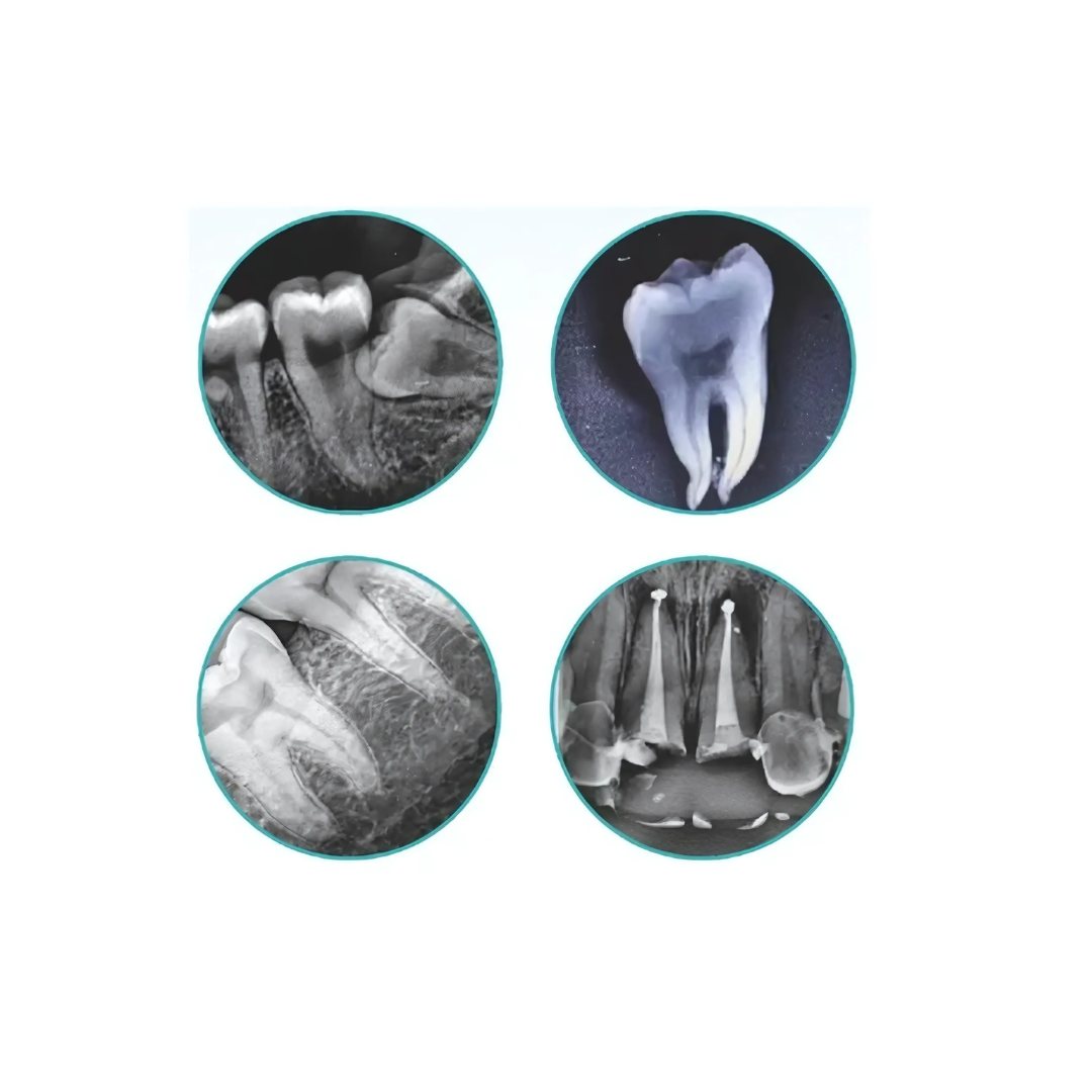 Smart Ray X Ray Machine - Portable