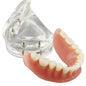 Over Denture Model