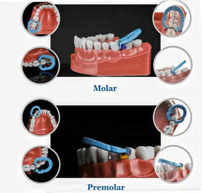 Younitrix Dental Ring