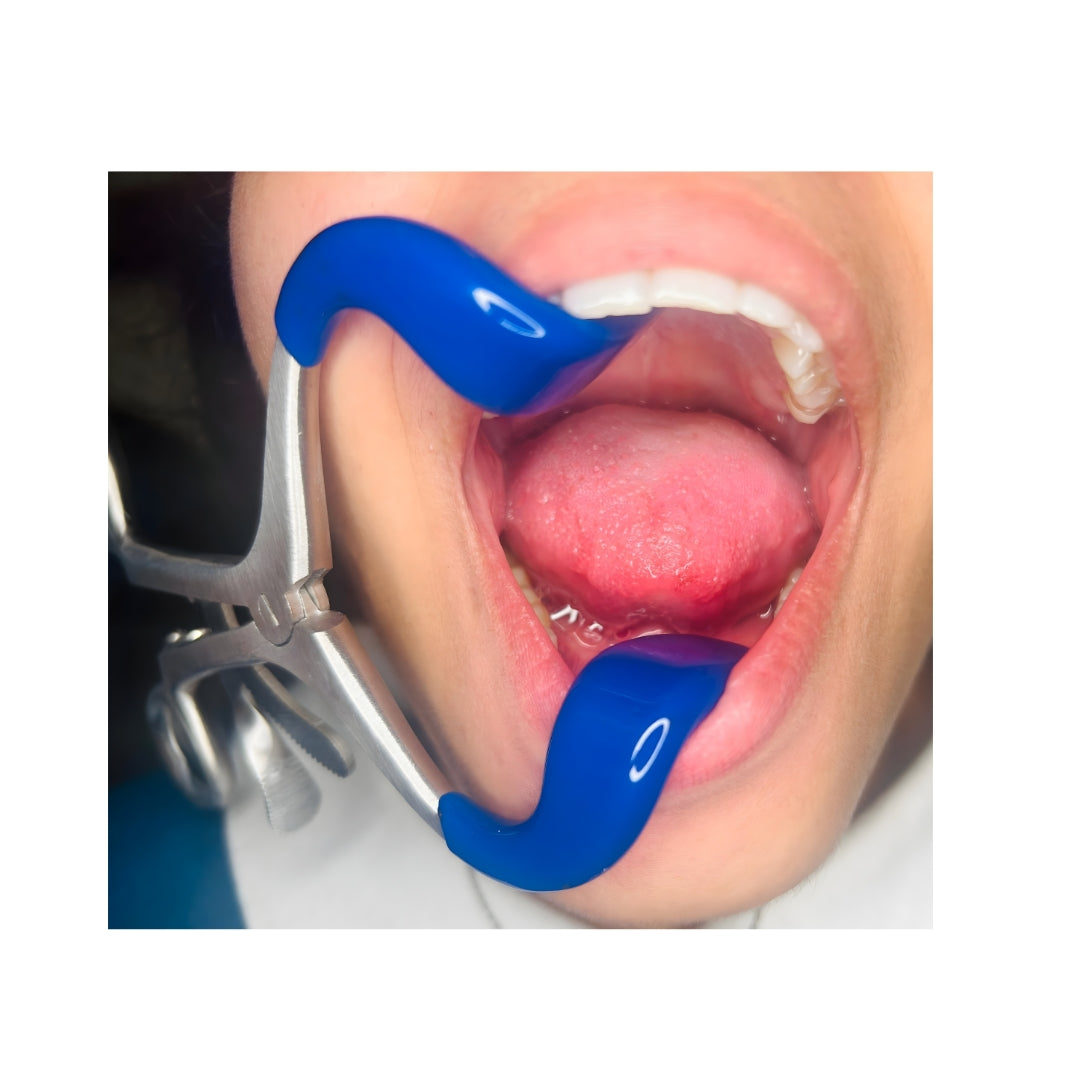 Mouth Gag Retractor