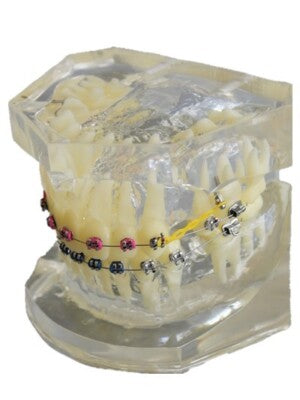Ortho Model