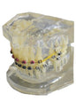 Ortho Model